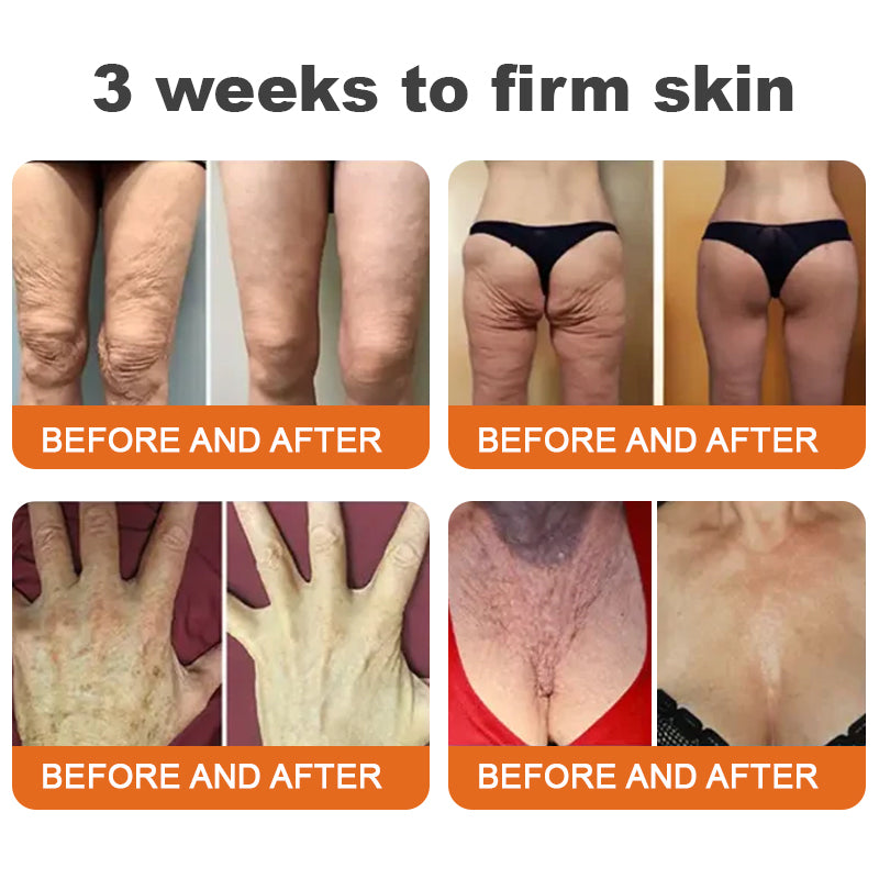 đFlysmus⢠Botox Bee Venom Firming Serum Stick LAST DAY 70% OFF