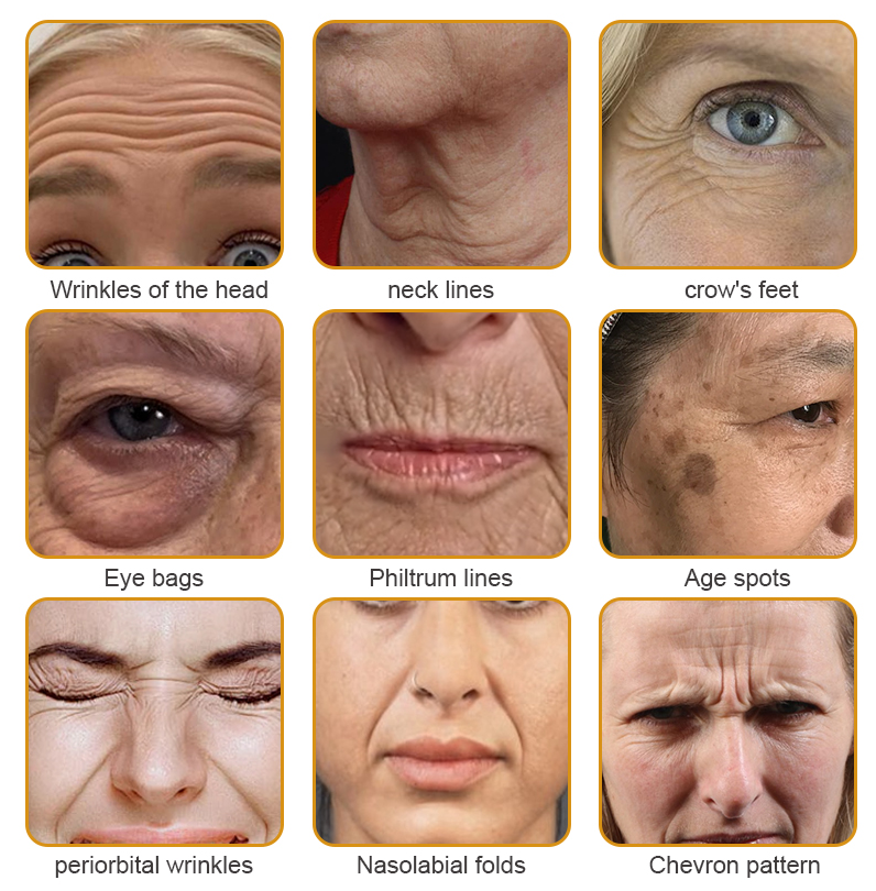 šFurzero⢠Botox Bee Venom Wrinkle Removal Cream-Last Day Promotion 70% OFF