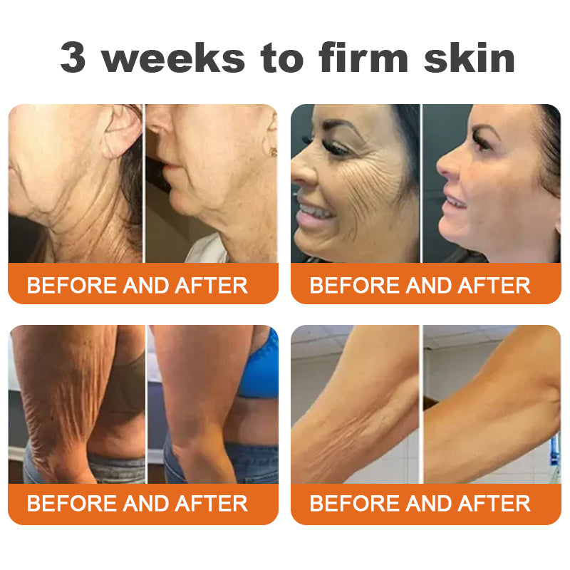 🍉Flysmus™ Botox Bee Venom Firming Serum Stick LAST DAY 70% OFF