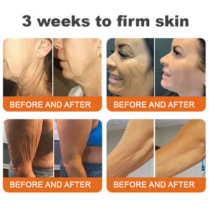 🍉Flysmus™ Botox Bee Venom Firming Serum Stick LAST DAY 70% OFF