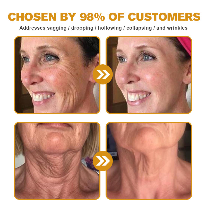 🍇Furzero™ Botox Bee Venom Wrinkle Removal Cream-Last Day Promotion 70% OFF