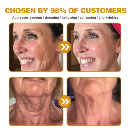 🍇Furzero™ Botox Bee Venom Wrinkle Removal Cream-Last Day Promotion 70% OFF
