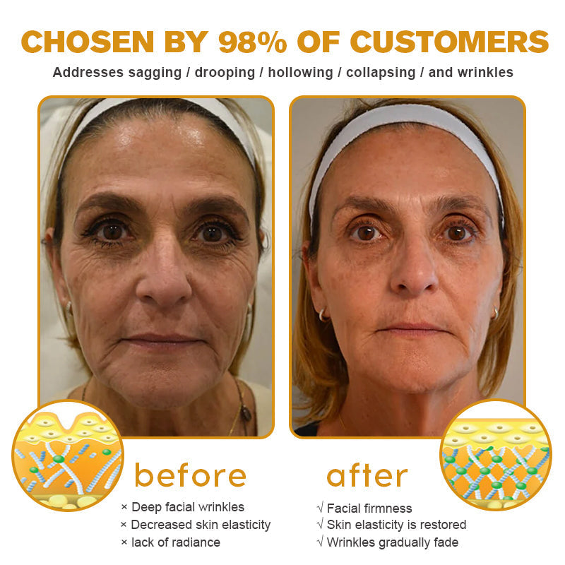 🍇Furzero™ Botox Bee Venom Wrinkle Removal Cream-Last Day Promotion 70% OFF