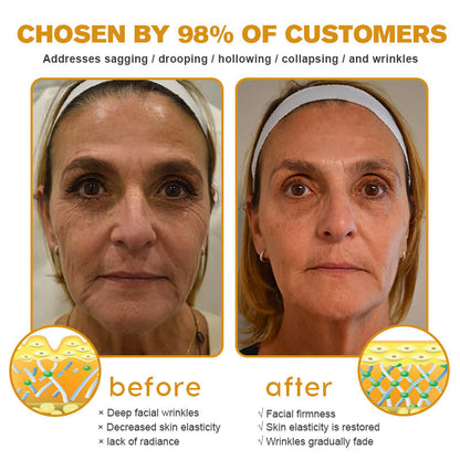 🍇Furzero™ Botox Bee Venom Wrinkle Removal Cream-Last Day Promotion 70% OFF